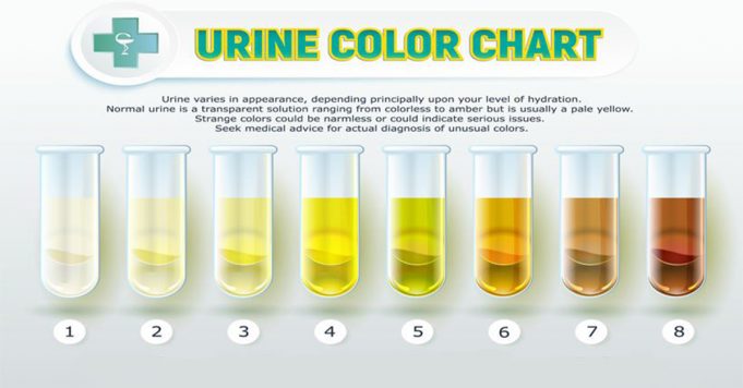 Dark Orange Urine In Dogs